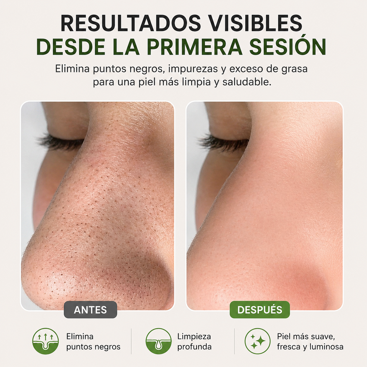 Extractor de espinillas a vapor | tu rutina facial de manera profesional desde casa.