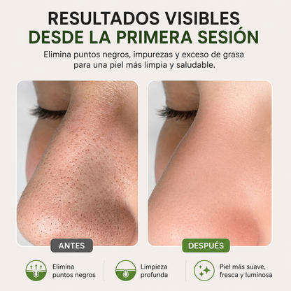 Extractor de espinillas a vapor | tu rutina facial de manera profesional desde casa.