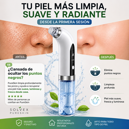 Extractor de espinillas a vapor | tu rutina facial de manera profesional desde casa.